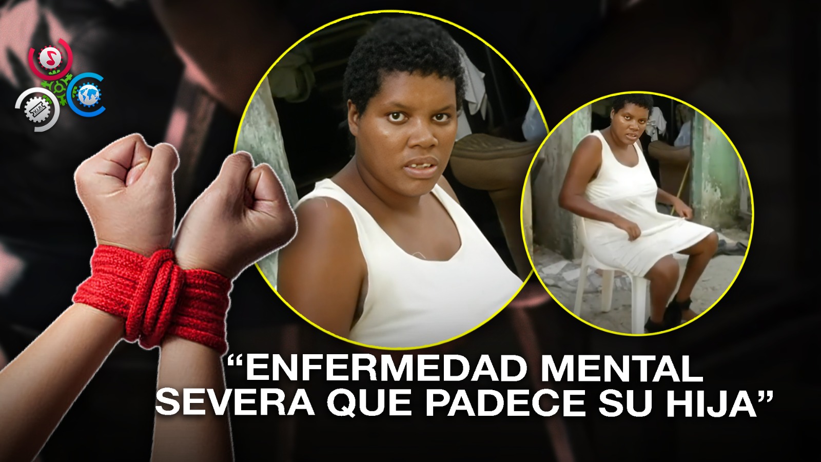 Enfermedad Mental Y Pobreza: Madre Se Ve Obligada A Amarrar A Su Hija Por Su Condición De Salud