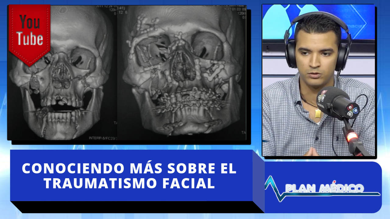 Conociendo Más Sobre El Traumatismo Facial En Plan Médico De Cachicha Tv