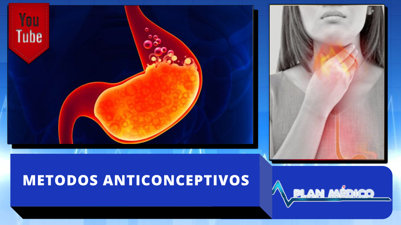 Conoce Que Es El Reflujo Gastroesofágico “Acidez” | Plan Médico