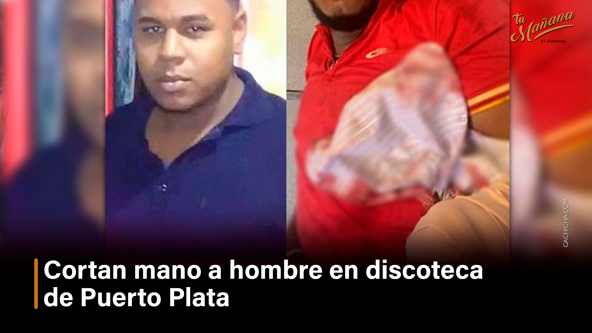 Cortan Mano A Hombre En Discoteca De Puerto Plata – Tu Mañana By Cachicha