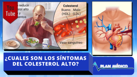 Entérate De ¿Cuáles Son Los Síntomas Del Colesterol Alto?