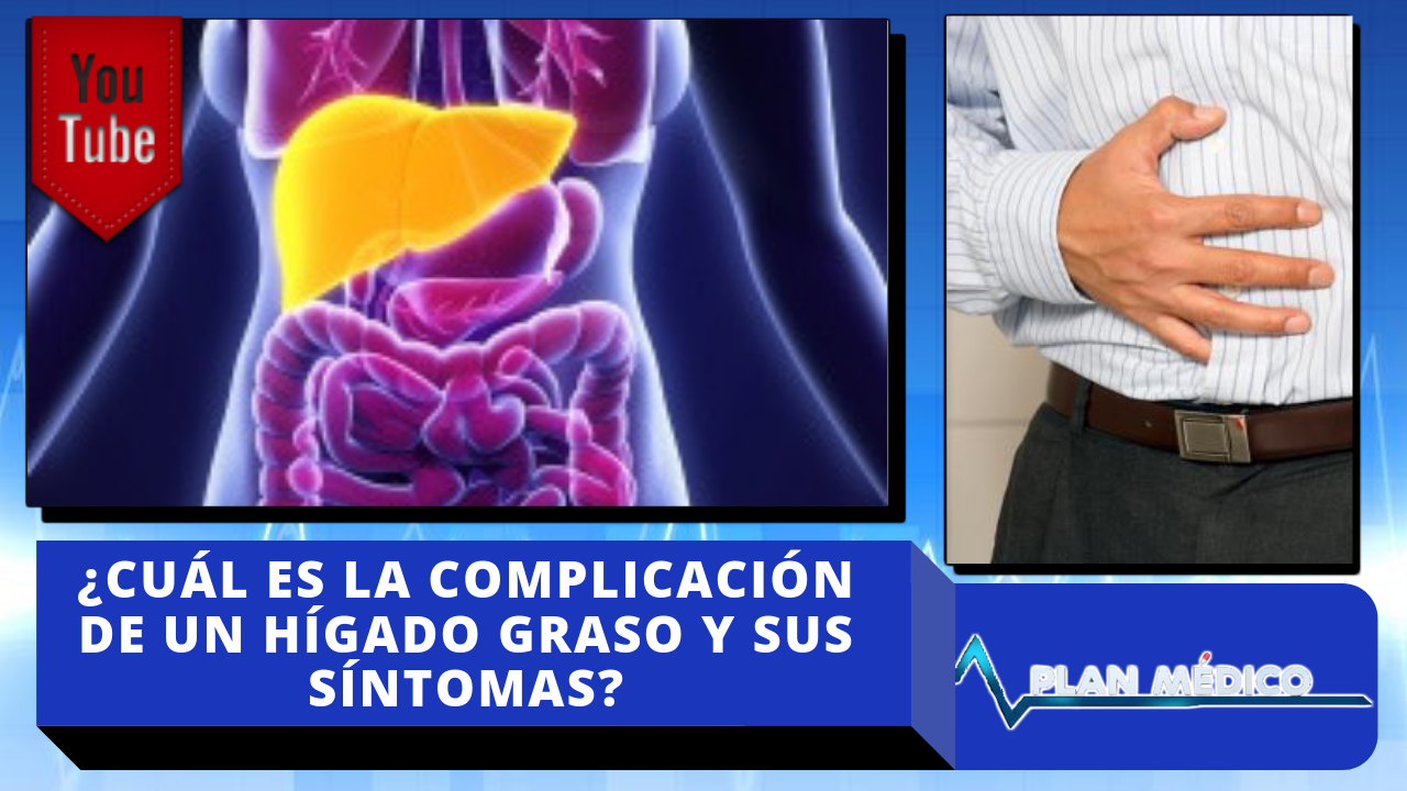 ¿Cuál Es La Complicación De Un Hígado Graso Y Sus Síntomas? Plan Médico De Cachicha Tv