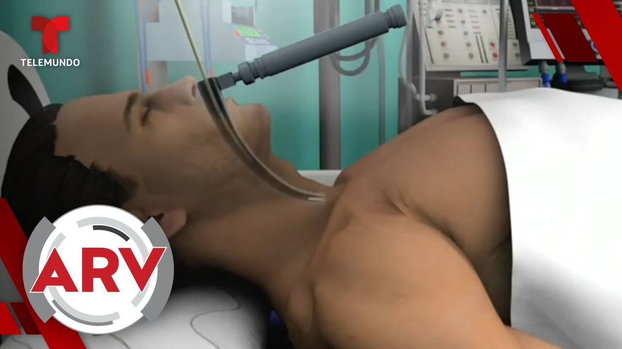 Cuál Es La Diferencia Entre Los Respiradores Y Ventiladores