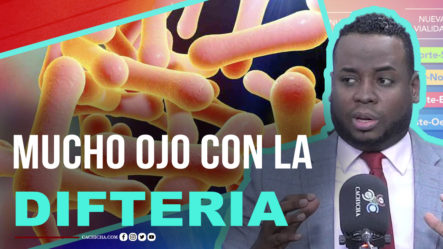 Mucho Ojo Con La Difteria En Los Niños Del País | Tu Mañana By Cachicha