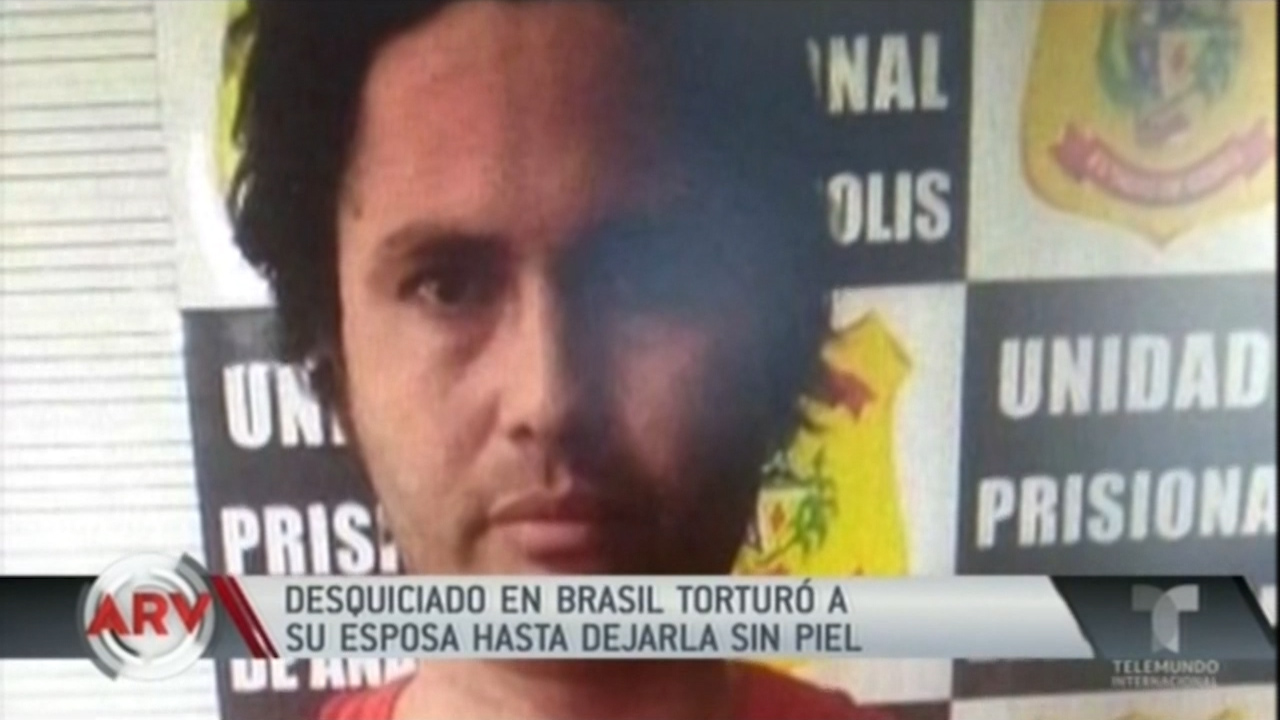 Desquiciado En Brasil Torturó A Su Esposa Hasta Dejarla Sin Piel