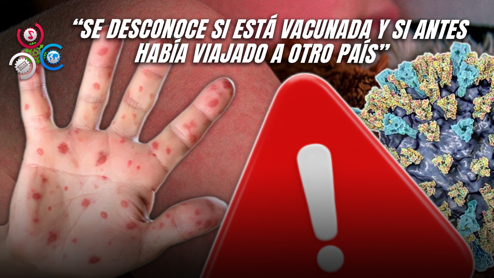 Detectan Caso De Sarampión En Washington D.C. Y Encienden Alarmas Sanitarias