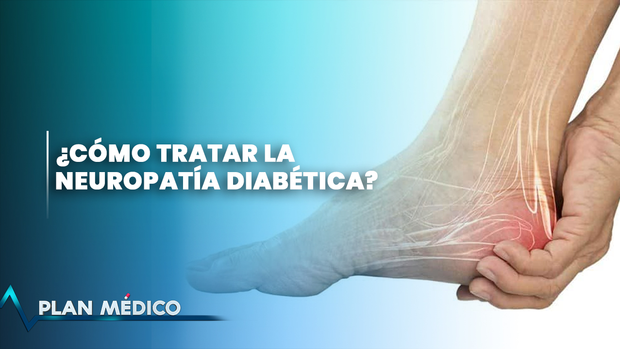 ¿Cómo Tratar La Neuropatía Diabética? | Plan Médico
