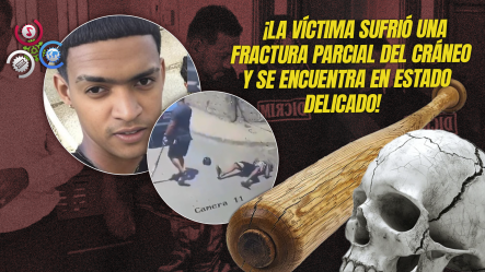 Dictan Tres Meses De Prisión Preventiva A Acusado De Golpear Con Un Bate A Joven En Mao