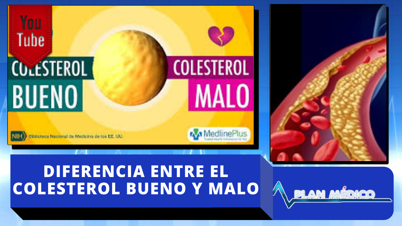 Conociendo Las Diferencia Entre El Colesterol Bueno Y Malo En Plan Médico De Cachicha Tv