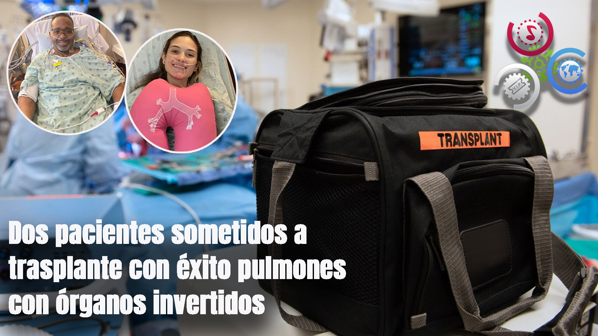 Dos Pacientes Sometidos A Trasplante Con éxito Pulmones Con órganos Invertidos