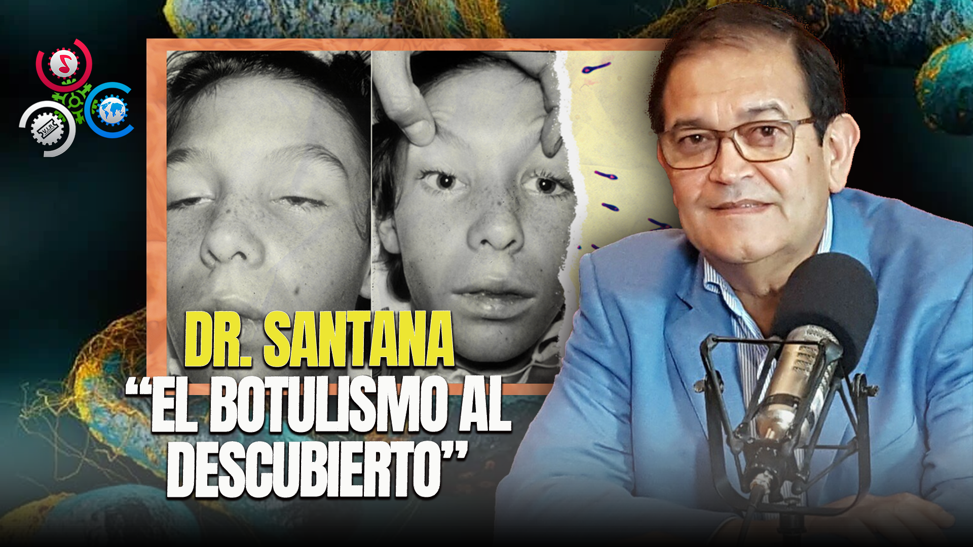 Dr. Santana Destapa Causas Del Botulismo En “El Mismo Golpe”