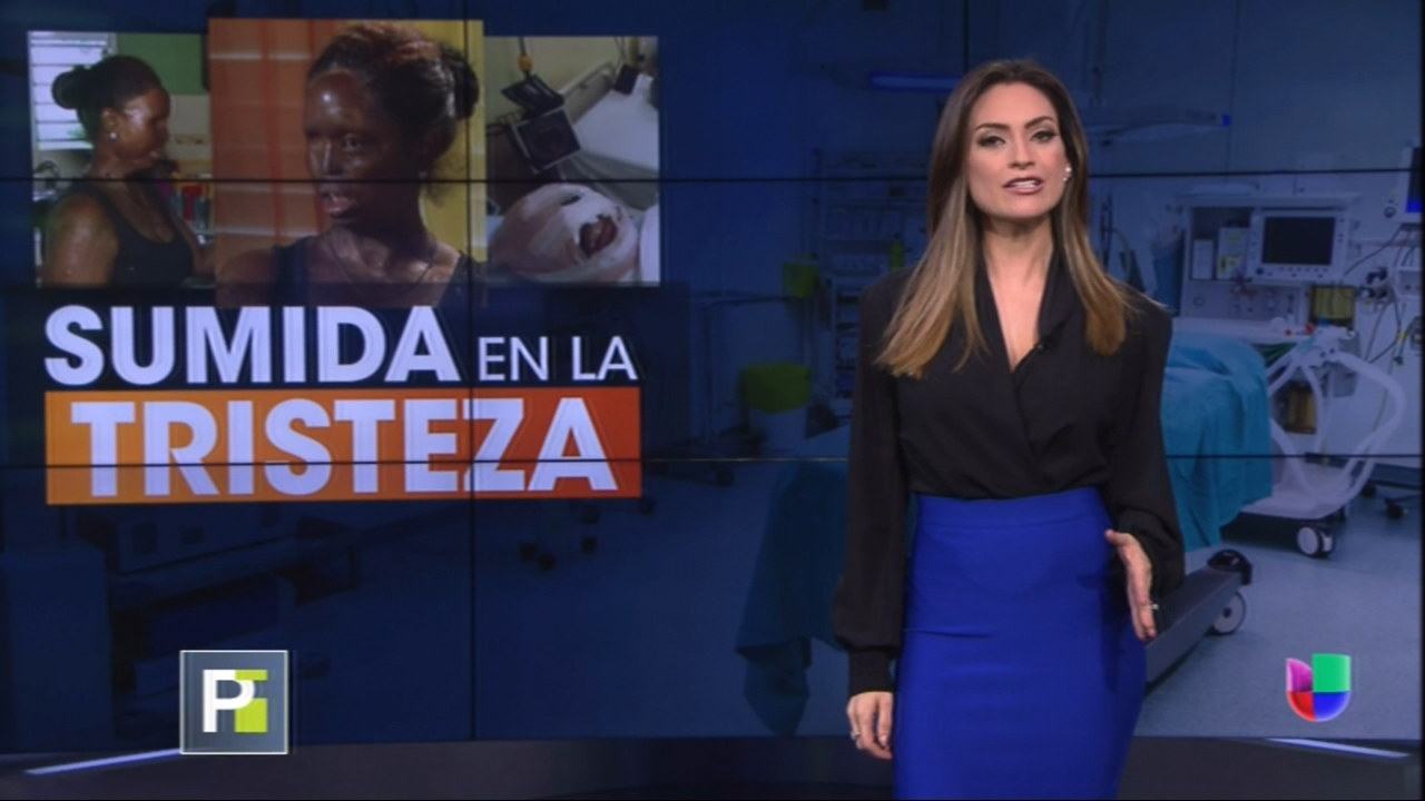 ¡IMÁGENES FUERTES! Madre De 4 Niños Pierde Prácticamente Su Rostro Tras Ser Atacada Con “Ácido Del Diablo” Y Hoy Cuenta Su Testimonio