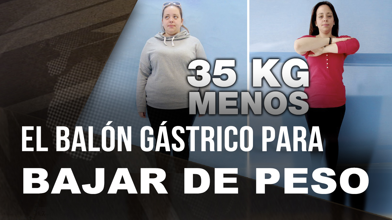 El Balón Gástrico, El Procedimiento Que Te Ayudará A Bajar De Peso Más Rápido