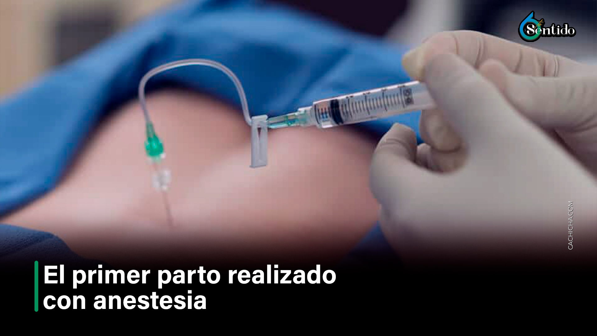 El Primer Parto Realizado Con Anestesia – 6to Sentido By Cachicha