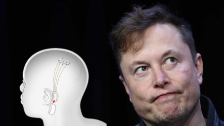 Elon Musk Presenta Neuralink, El Chip Cerebral Que Pretende Curar Enfermedades