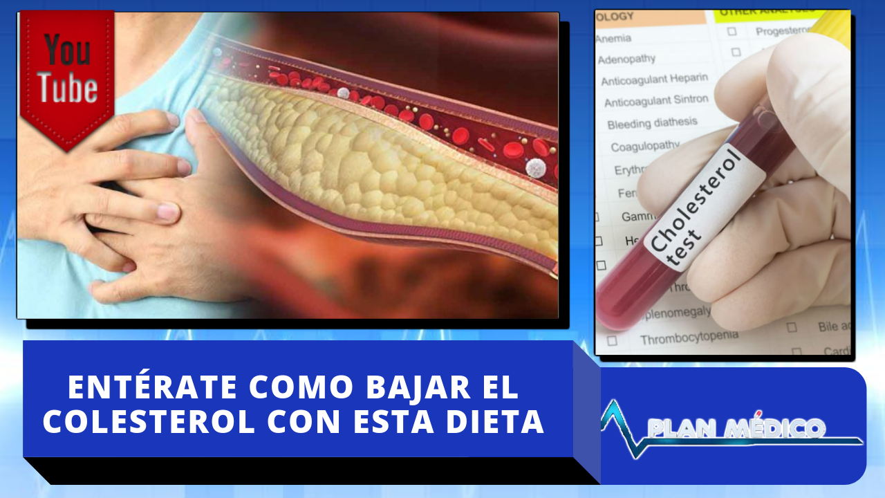 Entérate Como Bajar El Colesterol Con Esta Dieta En Plan Médico De Cachicha Tv