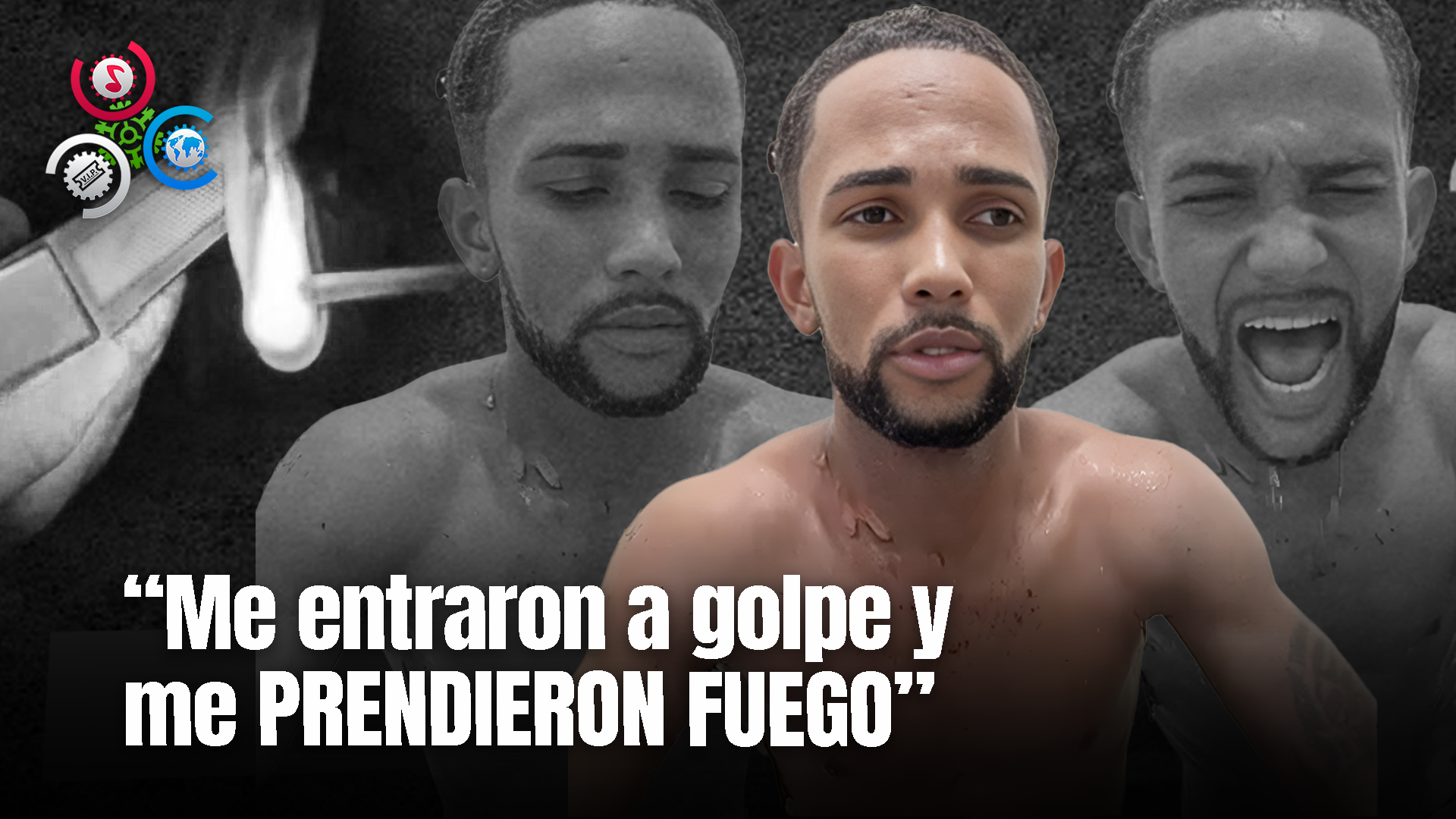 Desconocidos Prenden Fuego A Joven En Baní “Quemaduras De 2 Grado En 45% En Su Cuerpo”