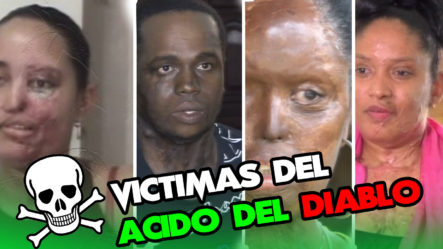 Reportaje Especial De Todas Las Personas Que Han Sido Afectadas Con El ácido Del Diablo En República Dominicana