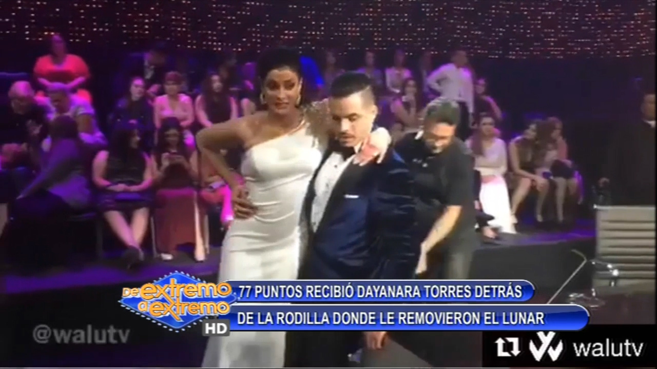Dayanara Torres Recibió 77 Puntos Detrás De La Rodilla Donde Le Removieron El Lunar
