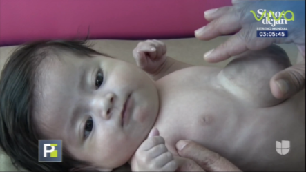 Bebé Con “el Corazón Latiendo Fuera Del Pecho” Sorprende Las Redes Sociales 
