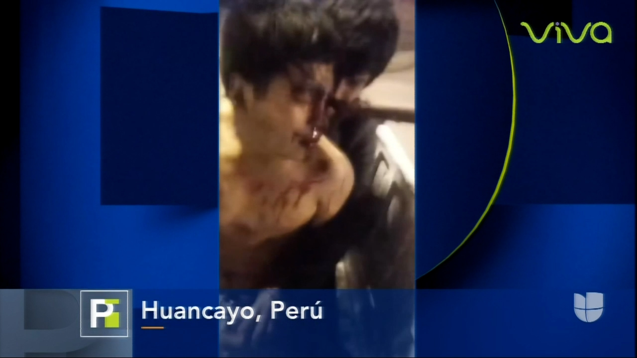 *IMÁGENES SENSIBLES* Dos Amigos Se Pelean Y Uno Le Clava Un Cuchillo A Otro En El Ojo