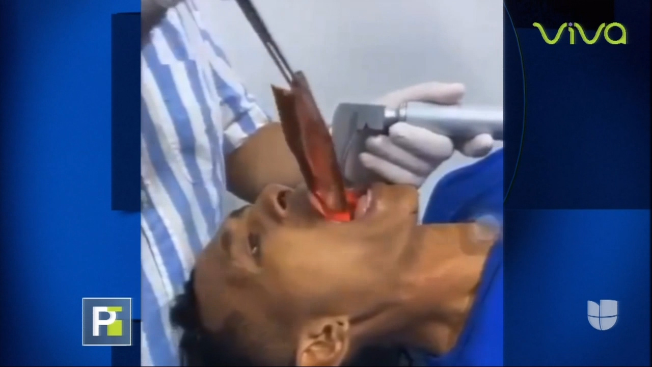 ¡INCREIBLE! Un Pez Se Le Entra En La Boca A Un Pescador Mientras Pescaba