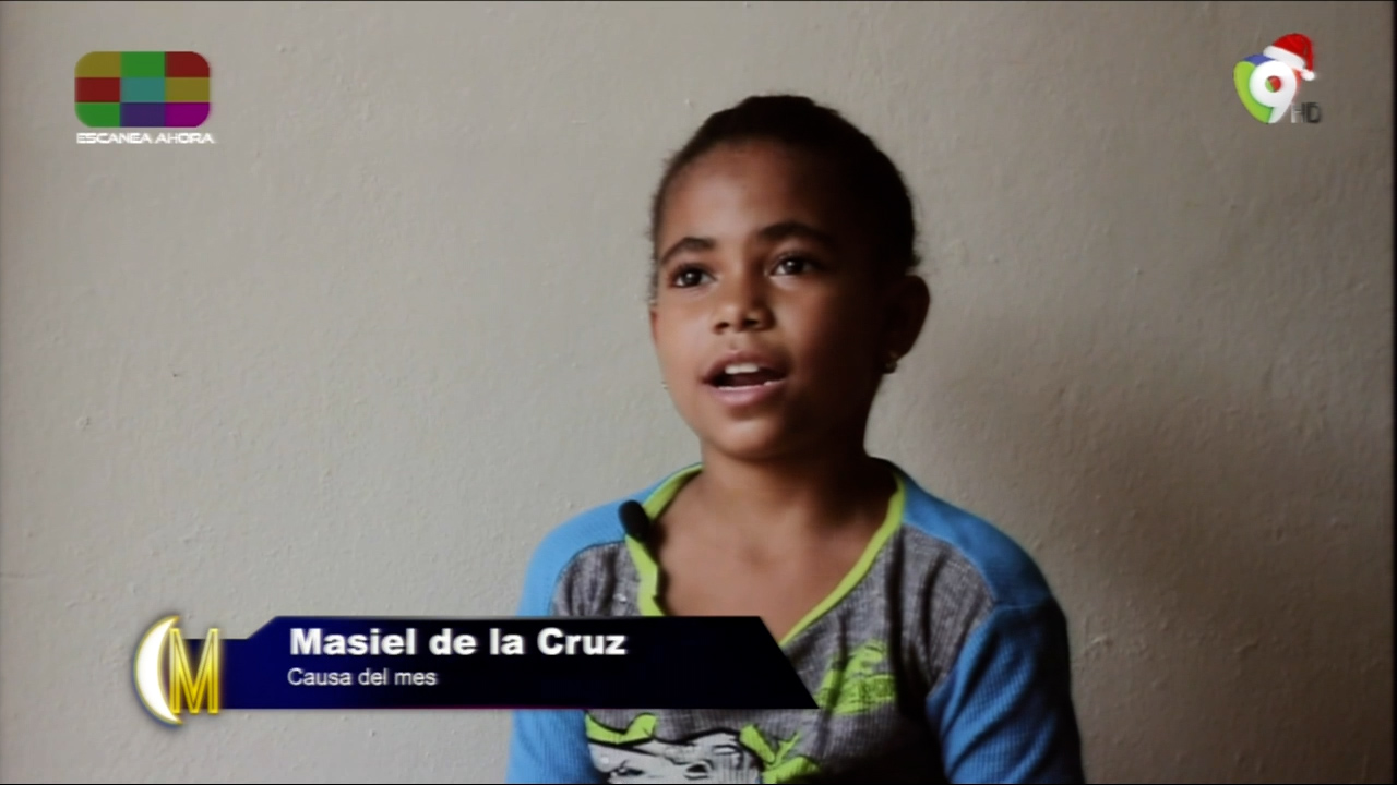 12 Meses De Causa – Masiel De La Cruz La Niña Con Un Gran Problema En Sus Piernas