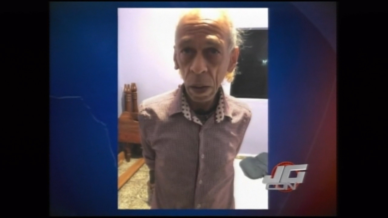 Hombre De 85 Es Agredido Brutalmente Por Su Hermano