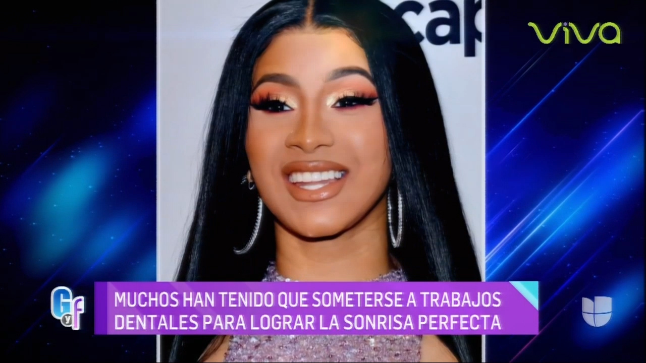 Personalidades Que Tenían Dientes Feos Y Ahora Presumen Su Dentadura 