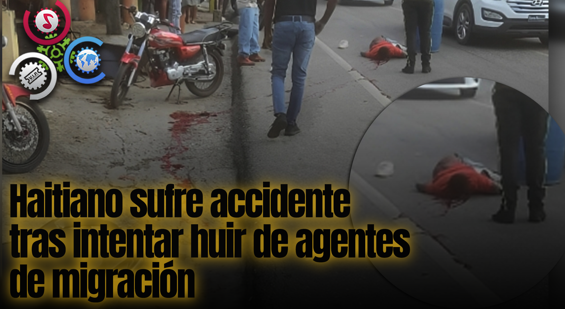 Haitiano Sufre Accidente Tras Intentar Huir De Agentes De Migración