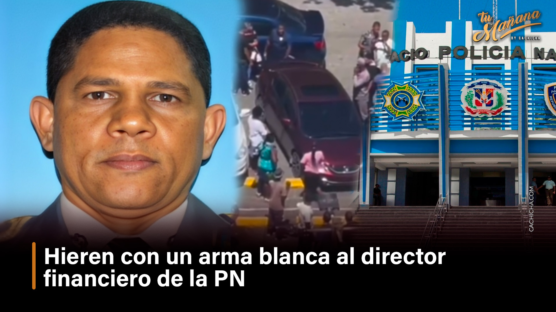 Hieren Con Un Arma Blanca Al Director Financiero De La PN