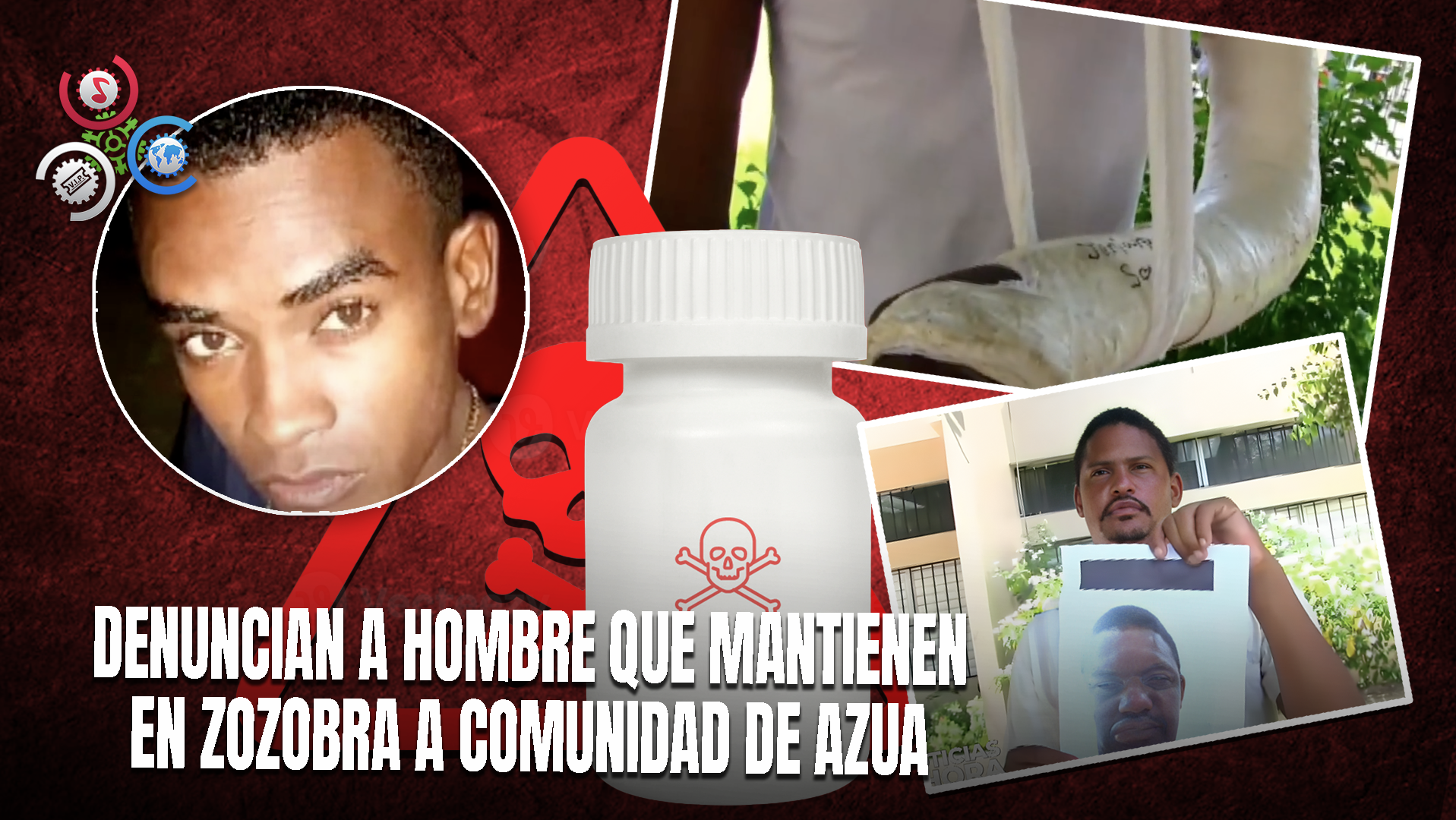 Ácido Del Diablo: Acusan A Un Hombre De Atacar A Otro Con Sustancia Y Golpear A Su Padre