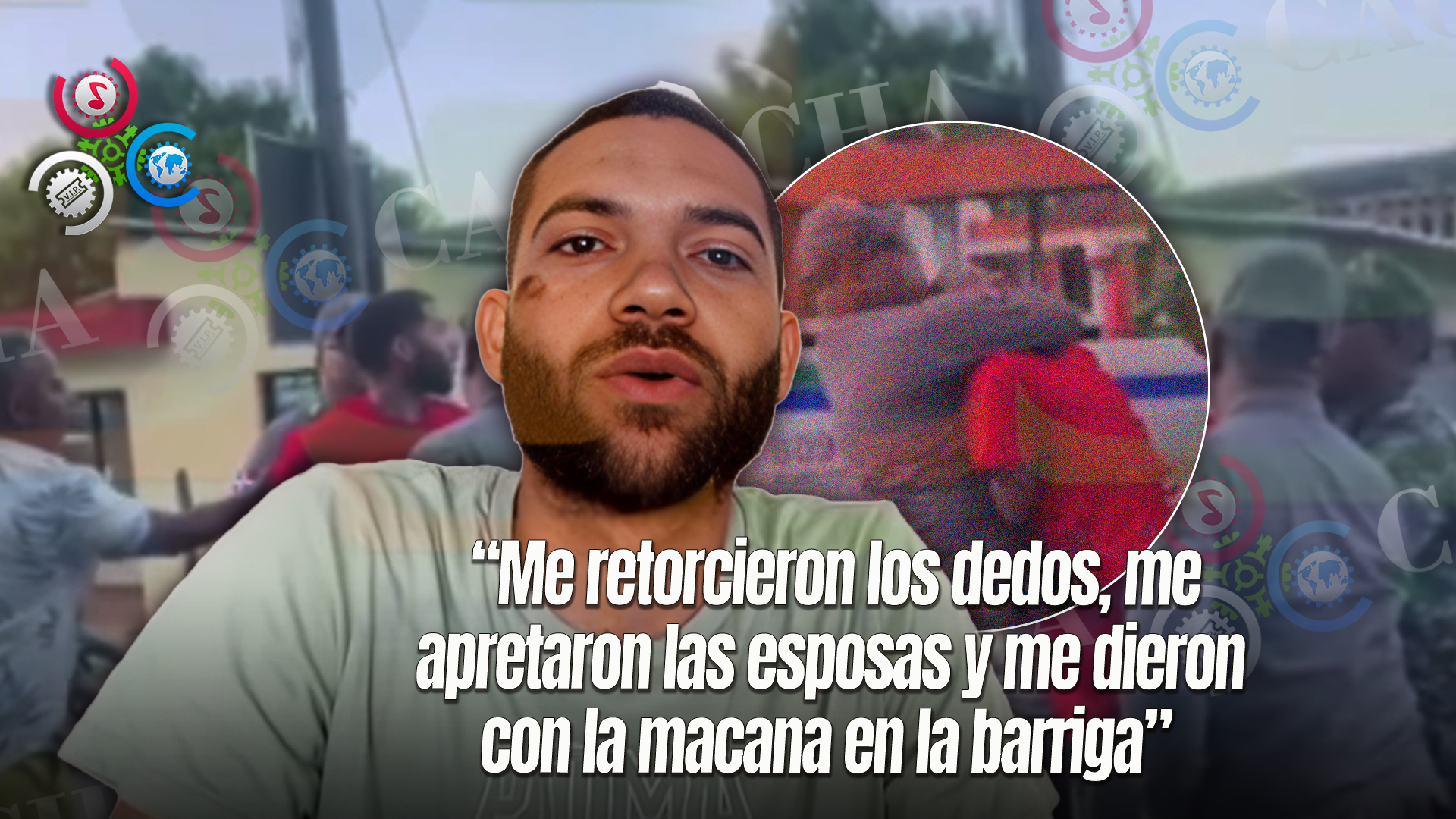 Hombre Denuncia Haber Sido Golpeado Por Policías Sin Razones Aparentes En Gaspar Hernández