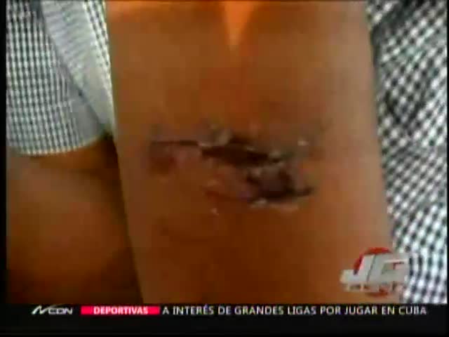 Hombre Denuncia Fue Torturado Por Policías En Villa Gonzales