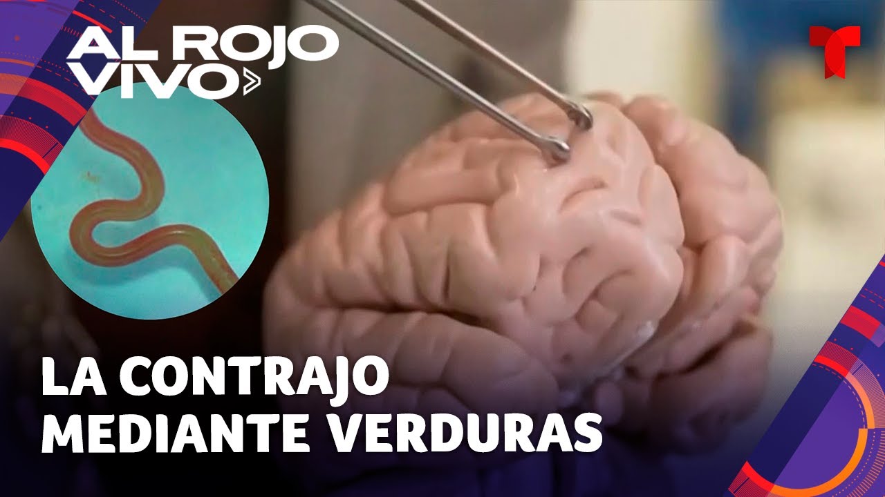 Extraen Un Gusano Vivo De Tres Pulgadas Del Cerebro De Una Mujer En Australia