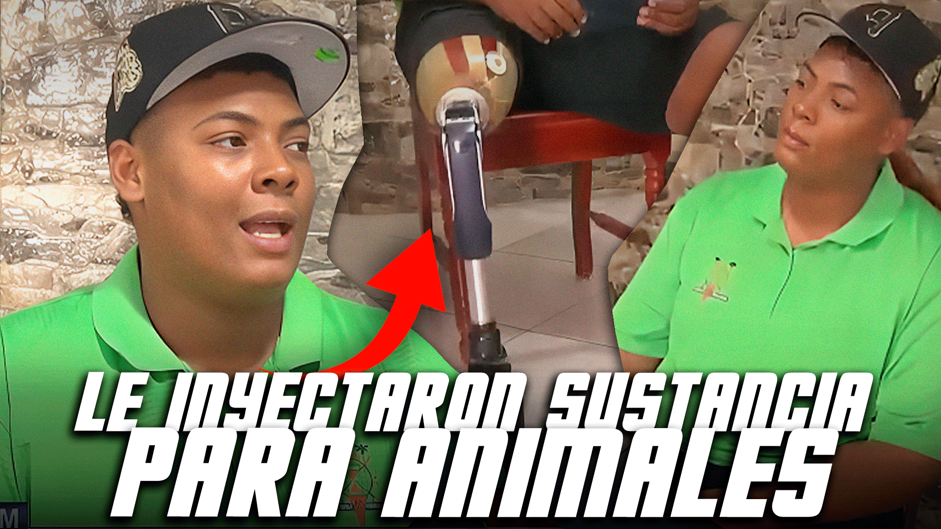 Ex Prospecto Con Pierna Amputada Tras Inyección De Sustancia PROHIBIDA Abraza La Vida Con Esperanza