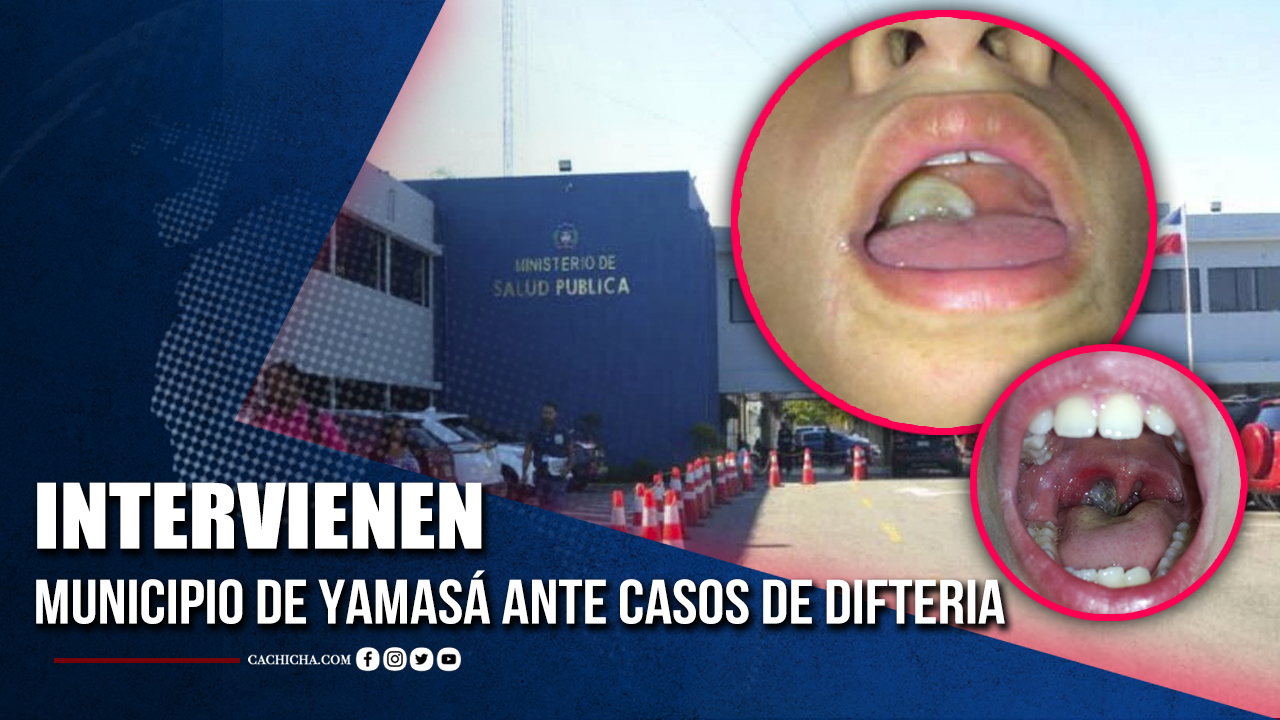 Intervienen Municipio De Yamasá Ante Casos De Difteria  | Tu Tarde
