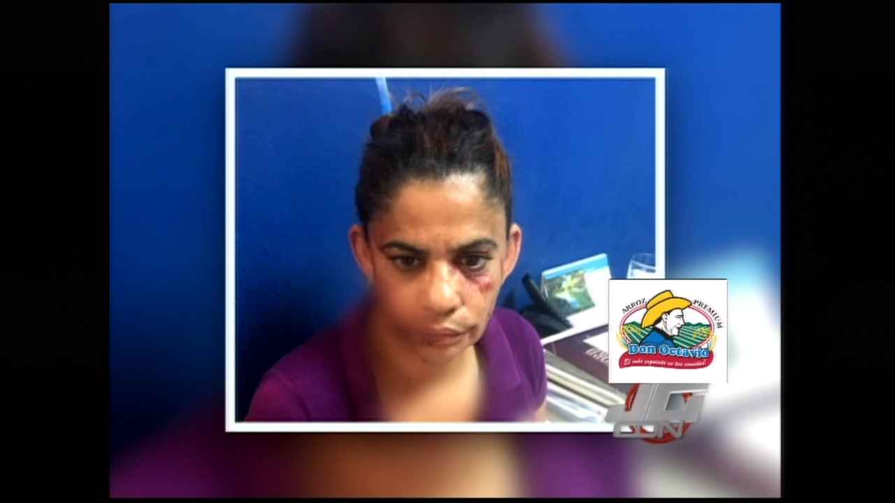 Conserje Le Desfigura El Rostro A Directora De Un Centro Educativo De San Francisco De Macoris