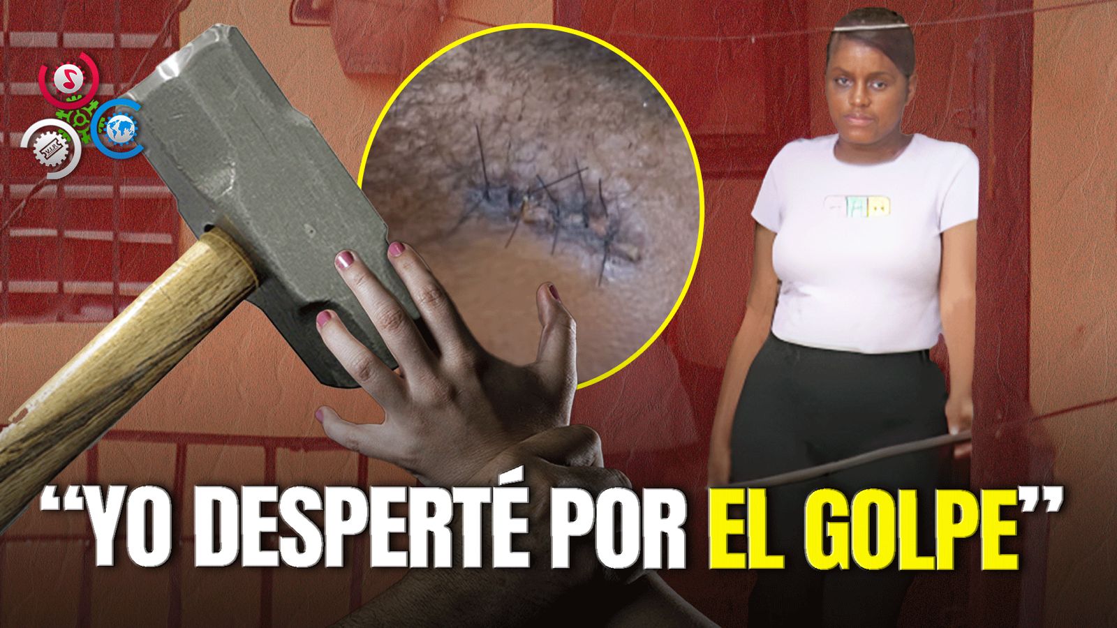 Joven Denuncia Fue Golpeada Brutalmente Con Mandaría Durante Intento De Abuso Sexual En Cristo Rey