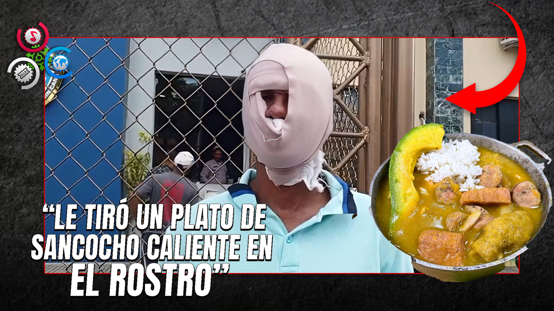 Joven Resulta Con Quemaduras Tras Reclamar Una Supuesta Deuda De 200 Pesos