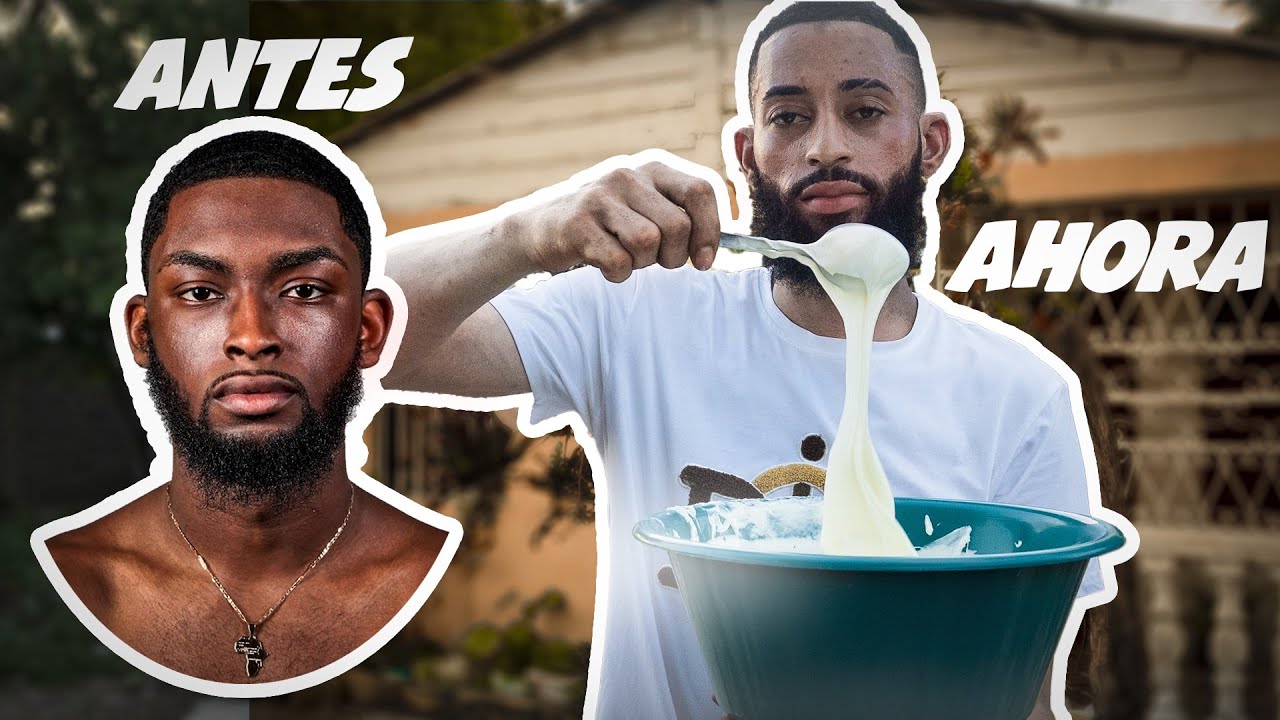 La Crema Que Lo Puso Blanco En 1 Día, ¿hace Daño? | Cap. 3