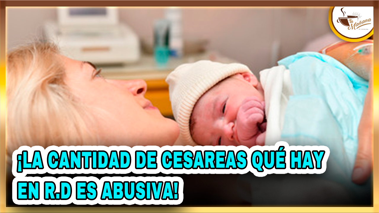 ¡La Cantidad De Cesáreas Que Hay En R.D Son Abusivas! | Tu Mañana By Cachicha