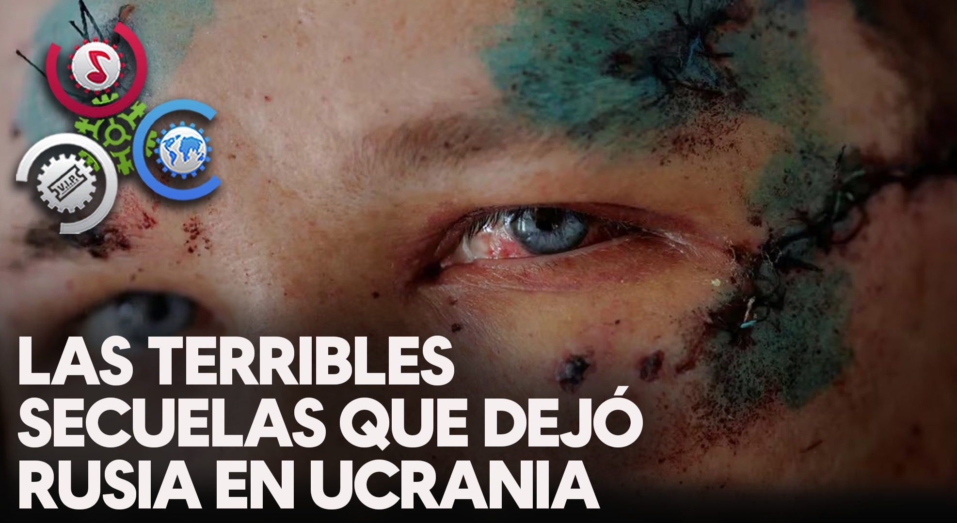 Las Terribles Secuelas Que Dejó Rusia En La Ucrania Liberada