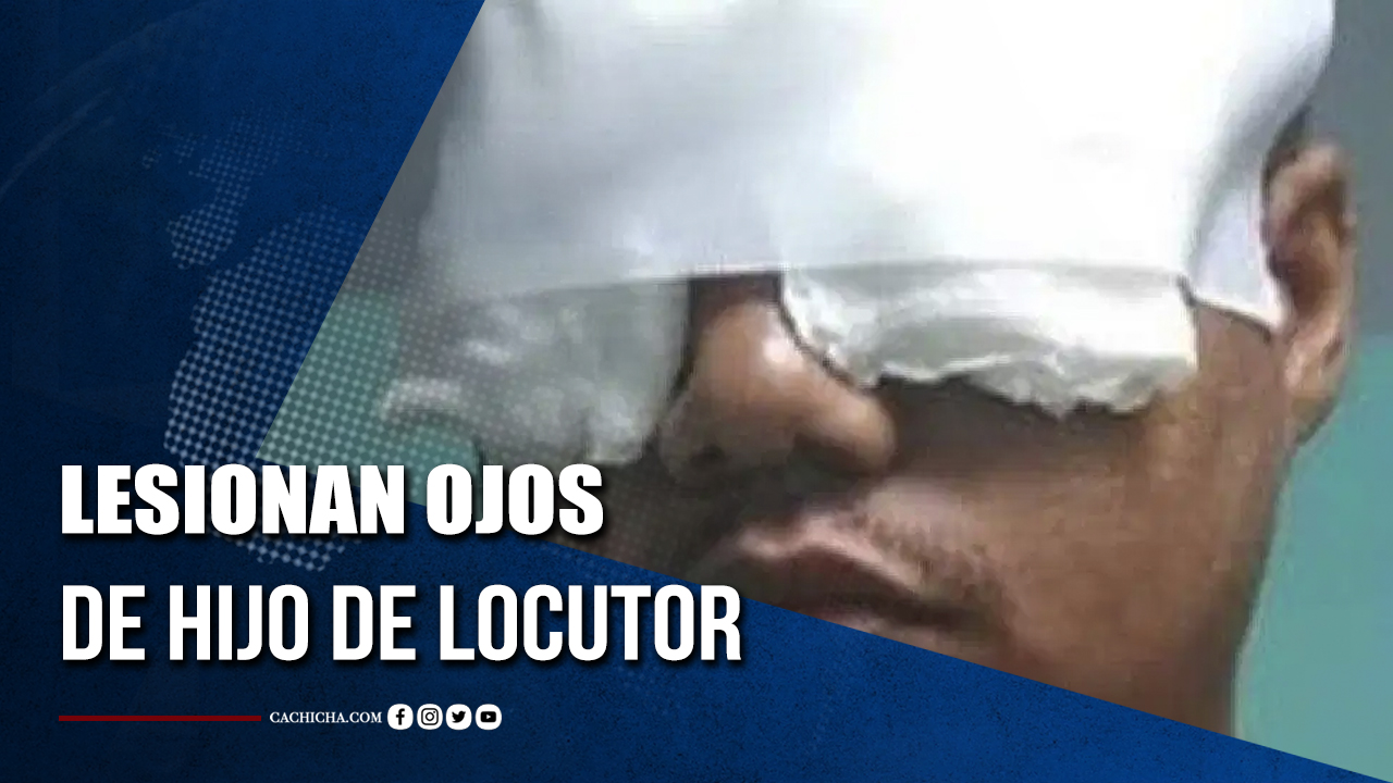Lesionan Ojos De Hijo De Locutor De La Romana | Tu Tarde