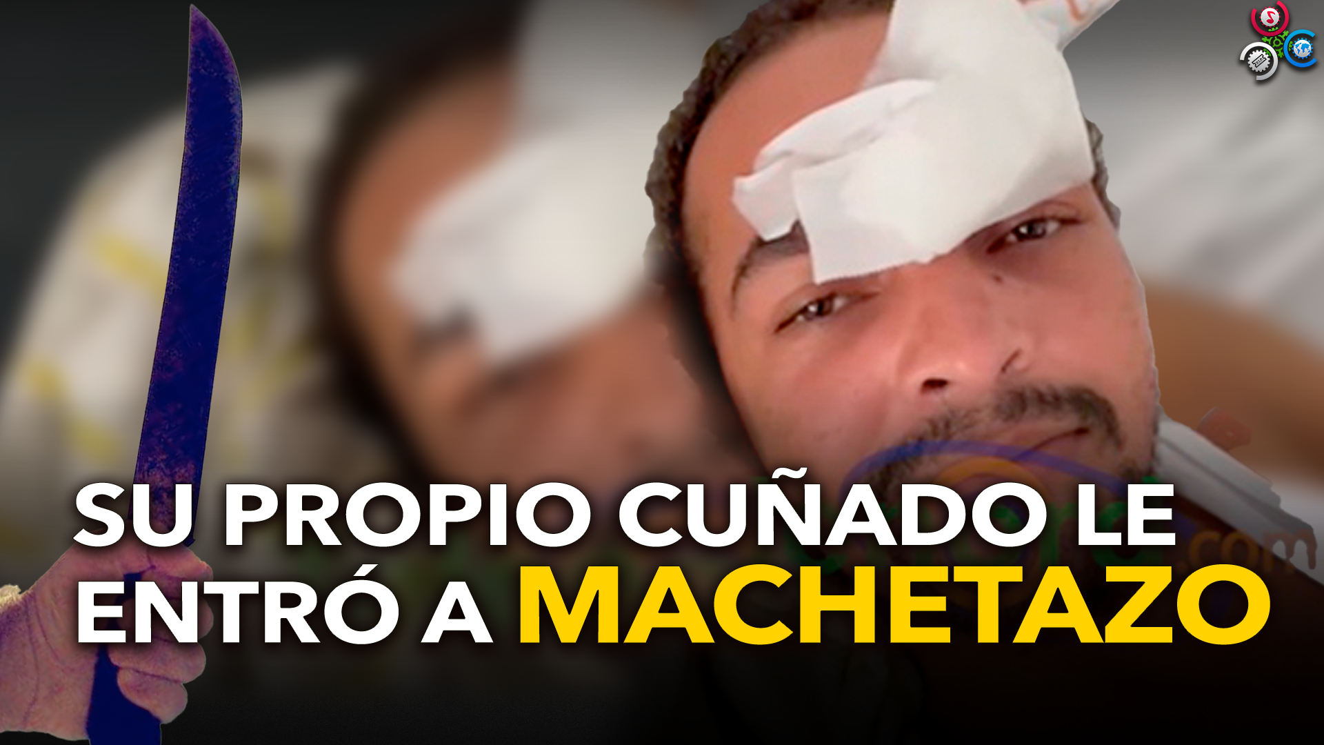 Joven Asegura Que Su Cuñado Lo Agredió A Machetazos