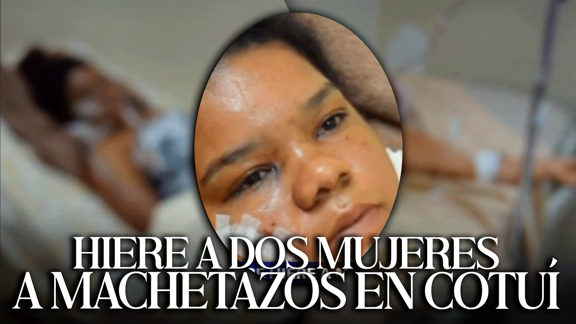 Hombre Hiere A MACHETAZOS A Dos Mujeres Por Presuntos CELOS En Cotuí