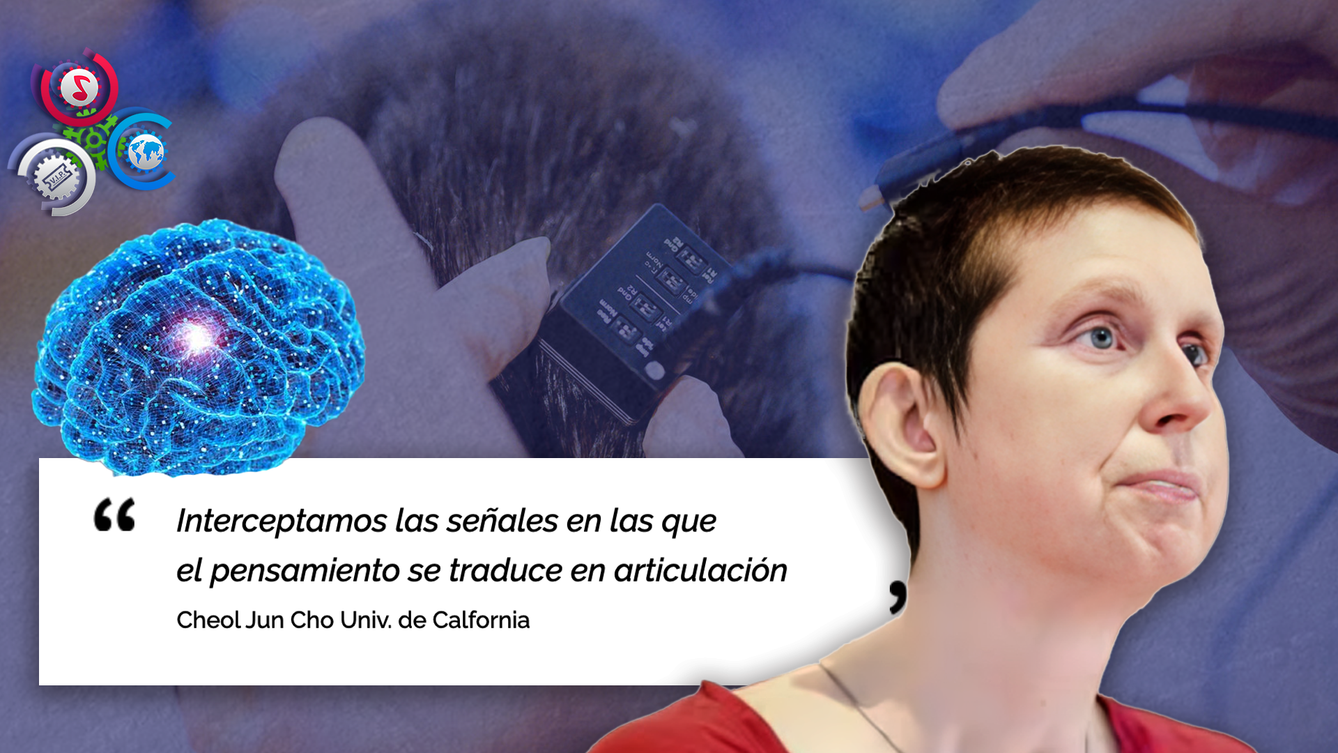 Mujer Con Parálisis Vuelve A “hablar” Tras 18 Años Gracias A Dispositivo Cerebral Que Traduce Pensamientos En Voz