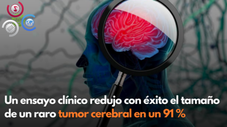 Un Ensayo Clínico Redujo Con éxito El Tamaño De Un Raro Tumor Cerebral En Un 91 %