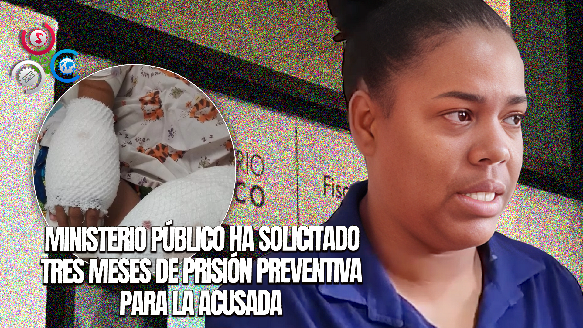 Conocerán Este Lunes Coerción Contra Mujer Acusada De Quemar Las Manos A Su Hijo En La Vega