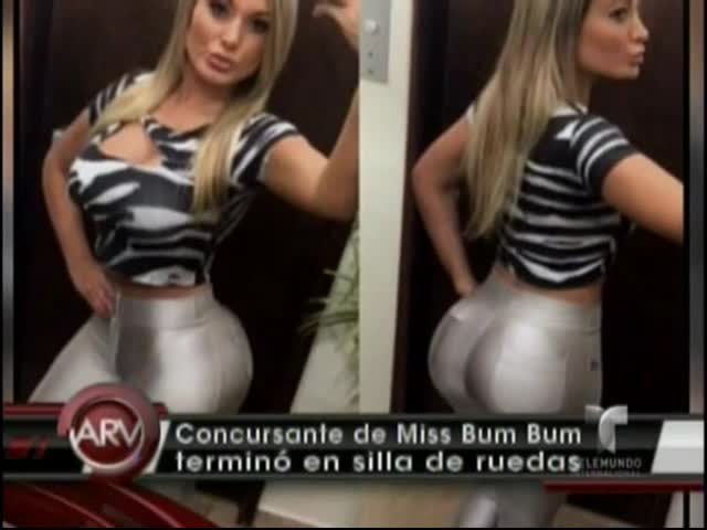 Concursante Del Miss Bum Bum Quedó En Silla De Ruedas Tras Operación Estética @AlRojoVivo